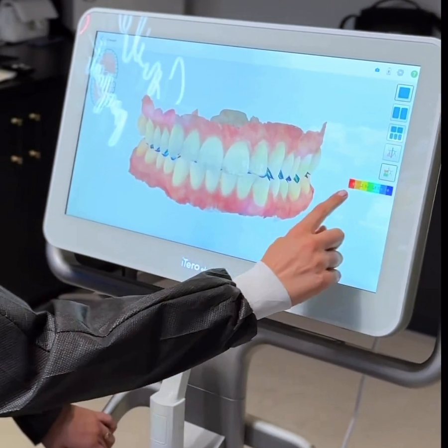 A patient viewing the 3D scan of her teeth on an iTero scanner screen
